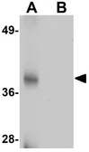 Anti-TMEM38A antibody used in Western Blot (WB). GTX85221