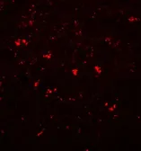 Anti-PPAPDC1A antibody used in IHC (Paraffin sections) (IHC-P). GTX85224
