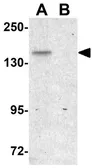Anti-FAM59B antibody used in Western Blot (WB). GTX85230