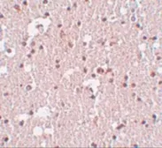 Anti-FRMPD3 antibody used in IHC (Paraffin sections) (IHC-P). GTX85235