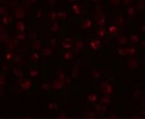 Anti-Mimitin antibody used in Immunocytochemistry/ Immunofluorescence (ICC/IF). GTX85237