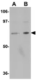 Anti-INSM2 antibody used in Western Blot (WB). GTX85242