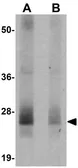 Anti-RWDD3 antibody used in Western Blot (WB). GTX85245