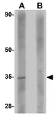 Anti-RWDD3 antibody used in Western Blot (WB). GTX85246