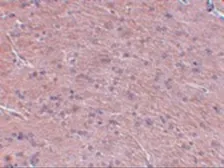 Anti-Prosapip1 antibody used in IHC (Paraffin sections) (IHC-P). GTX85249
