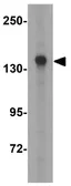 Anti-KDM3A antibody used in Western Blot (WB). GTX85253