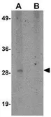 Anti-SYPL1 antibody used in Western Blot (WB). GTX85262