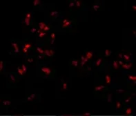 Anti-SCARA5 antibody used in Immunocytochemistry/ Immunofluorescence (ICC/IF). GTX85270