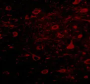 Anti-ZNF667 antibody used in IHC (Paraffin sections) (IHC-P). GTX85276