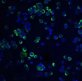 Anti-RGS21 antibody used in Immunocytochemistry/ Immunofluorescence (ICC/IF). GTX85280