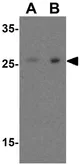 Anti-RSPO1 antibody used in Western Blot (WB). GTX85282