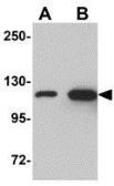 Anti-beta Galactosidase antibody used in Western Blot (WB). GTX85284