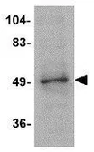 Anti-ZBTB2 antibody used in Western Blot (WB). GTX85352