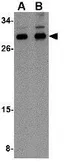 Anti-NIPSNAP3B antibody used in Western Blot (WB). GTX85354