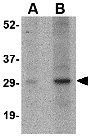 Anti-GBAS antibody used in Western Blot (WB). GTX85356