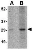 Anti-GBAS antibody used in Western Blot (WB). GTX85356