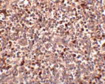 Anti-PIG-Y antibody used in IHC (Paraffin sections) (IHC-P). GTX85360
