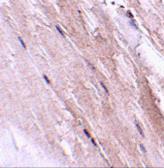 Anti-GBAS antibody used in IHC (Paraffin sections) (IHC-P). GTX85361