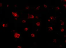 Anti-JPH3 antibody used in IHC (Paraffin sections) (IHC-P). GTX85363