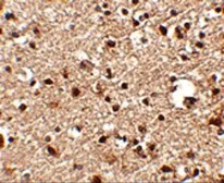 Anti-JPH4 antibody used in IHC (Paraffin sections) (IHC-P). GTX85365