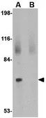 Anti-JPH2 antibody used in Western Blot (WB). GTX85367