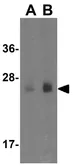Anti-MettL7B antibody used in Western Blot (WB). GTX85368