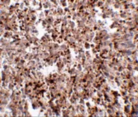 Anti-MettL7B antibody used in IHC (Paraffin sections) (IHC-P). GTX85370