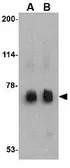 Anti-MEX3C antibody used in Western Blot (WB). GTX85374