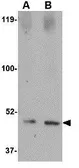 Anti-Spred1 antibody used in Western Blot (WB). GTX85376