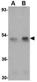 Anti-Spred1 antibody used in Western Blot (WB). GTX85377