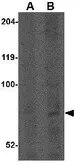 Anti-CNOT4 antibody used in Western Blot (WB). GTX85379