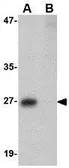 Anti-PRTFDC1 antibody used in Western Blot (WB). GTX85380