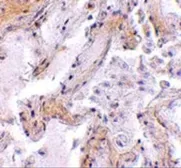 Anti-Calpain 6 antibody used in IHC (Paraffin sections) (IHC-P). GTX85383