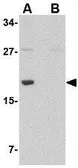 Anti-MED28 antibody used in Western Blot (WB). GTX85388