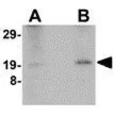 Anti-Nanos2 antibody used in Western Blot (WB). GTX85392