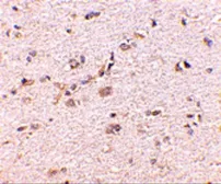 Anti-DLGAP1 antibody used in IHC (Paraffin sections) (IHC-P). GTX85396