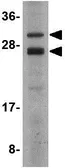 Anti-COPS8 antibody used in Western Blot (WB). GTX85400