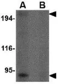 Anti-RGPD5 antibody used in Western Blot (WB). GTX85401