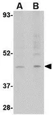 Anti-RGP1 antibody used in Western Blot (WB). GTX85404