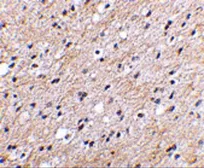 Anti-NIPSNAP antibody used in IHC (Paraffin sections) (IHC-P). GTX85406
