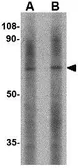 Anti-LGI2 antibody used in Western Blot (WB). GTX85408