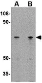 Anti-LGI2 antibody used in Western Blot (WB). GTX85409