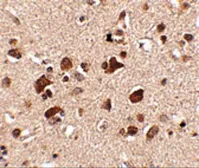 Anti-SLITRK6 antibody used in IHC (Paraffin sections) (IHC-P). GTX85412
