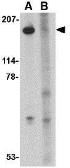Anti-Slitrk5 antibody used in Western Blot (WB). GTX85413