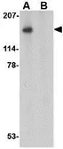 Anti-Slitrk5 antibody used in Western Blot (WB). GTX85414