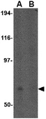 Anti-FNBP1L antibody used in Western Blot (WB). GTX85424