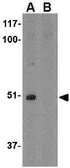 Anti-FNBP1L antibody used in Western Blot (WB). GTX85425