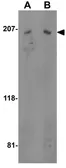 Anti-TEM4 antibody used in Western Blot (WB). GTX85426