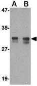 Anti-RASD2 antibody used in Western Blot (WB). GTX85427