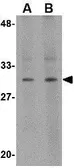Anti-RASD2 antibody used in Western Blot (WB). GTX85428